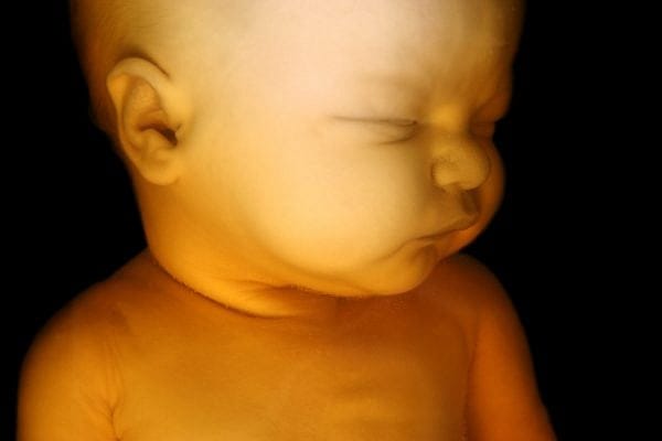 New Hampshire Senators Defend Late-Term Abortion
