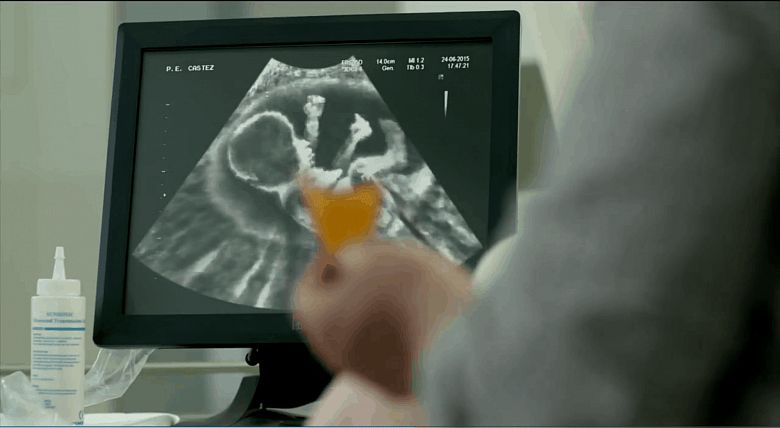 NARAL denounces Doritos spot as ‘humanizing’ a fetus – D’oh!
